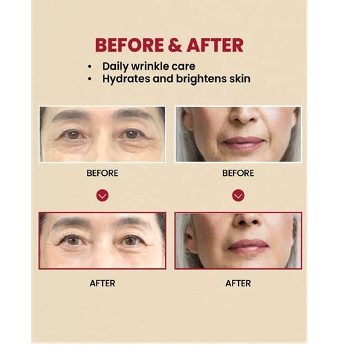 کرم رتینال لیپوزوم 1% و برنج سئول 50 میل