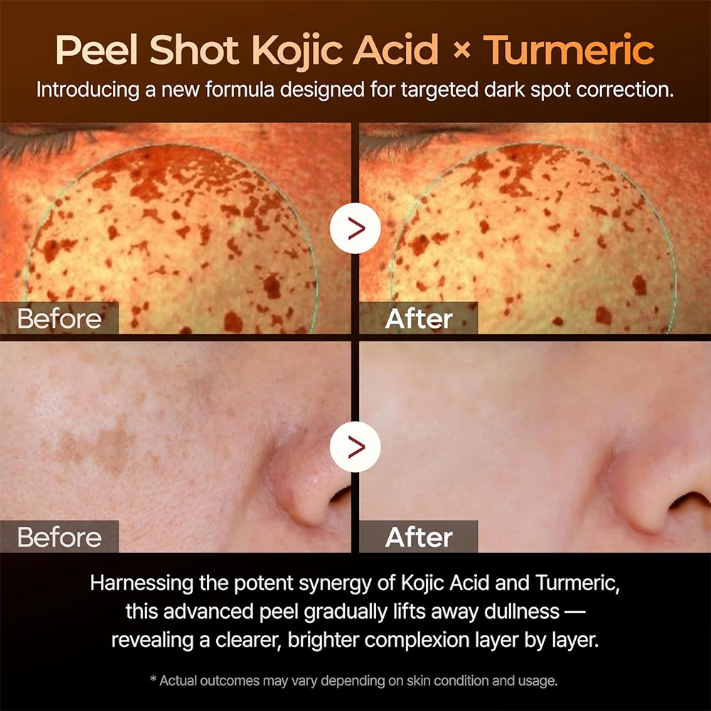 سرم پیل شات کوجیک اسید و زردچوبه دکتر ملاکسین لایه بردار ملایم وروشن کننده قوی پوست 200 میل Dr.Melaxin Peel Shot Exfoliating Kojic Acid Turmeric Serum