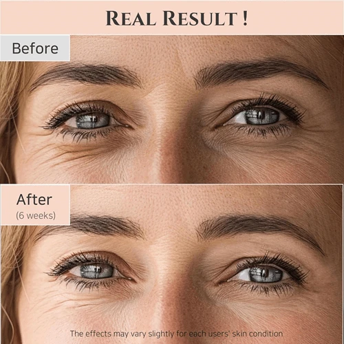 سرم دور چشم بیوتی آف جوسان حاوی جنسینگ و رتینال 30 میل