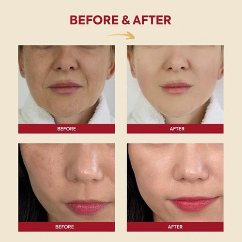 اسنس ترمیم کننده موسین حلزون و برنج سئول 100 میل