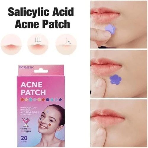 پچ ضدجوش طرحدار کورمسیک 20 عددی