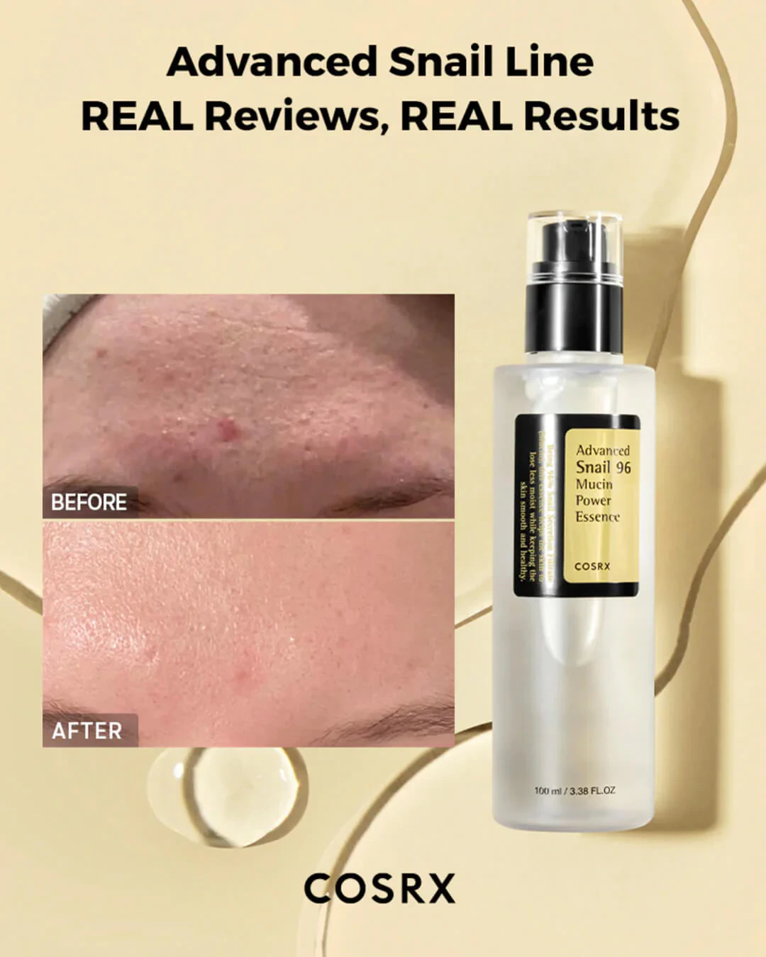 اسنس حلزون کوزارکس - آبرسان 100 میل