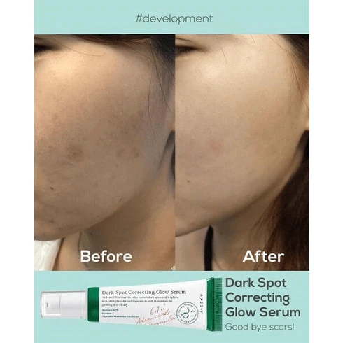 سرم ضدلک و روشن کننده دارک اسپات اکسیس وای 50 میل